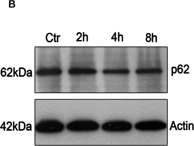 ADP-Ribosylation Factor-Interacting Protein 2 Acts as a Novel Regulator of Mitophagy and Autophagy in Podocytes in Diabetic Nephropathy.
