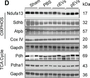 Fig.5.D showing Western Blotting in a Homo sapiens (Human) sample from the publication: Nitric oxide-primed engineered extracellular vesicles restore bioenergetics in acute kidney injury via mitochondrial transfer.