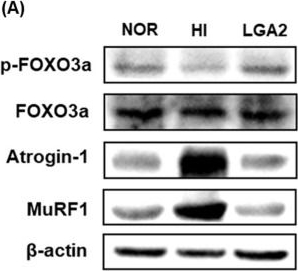 Fig.7.A showing Western Blotting in a Mus musculus (House mouse) sample from the publication: Lactobacillus gasseri CBT LGA2 alleviates muscle protein degradation and inflammation in immobilization-induced mouse.