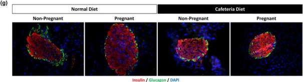 Fig.1.G showing Immunohistochemistry-immunofluorescence in a Mus musculus (House mouse) sample from the publication: Cafeteria diet compromises natural adaptations of islet cell transdifferentiation and turnover in pregnancy.