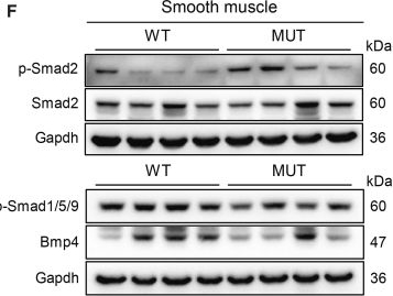 Fig.4.F showing Western Blotting in a Mus musculus (House mouse) sample from the publication: Keratin 20 deficiency phenocopies human UAB and drives bladder fibrosis via a mechanotransduction-TGF-β axis.