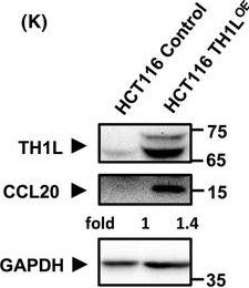 Fig.4.K showing Western Blotting from the publication: TH1L involvement in colorectal cancer pathogenesis by regulation of CCL20 through the NF-κB signalling pathway.