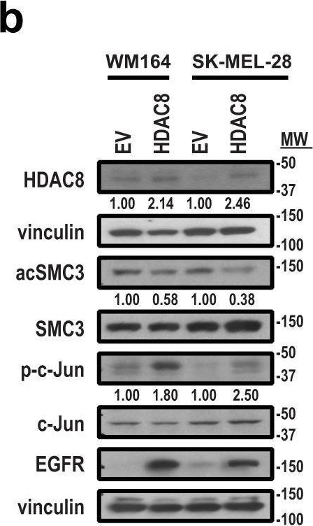 Fig.1.B showing Western Blotting in a Homo sapiens (Human) sample from the publication: HDAC8-mediated inhibition of EP300 drives a transcriptional state that increases melanoma brain metastasis.