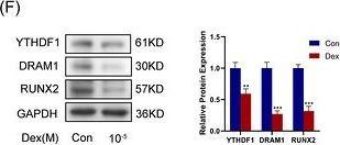 Fig.1.F showing Western Blotting in a Mus musculus (House mouse) sample from the publication: m6A-modified DRAM1 recognized by YTHDF1 regulates autophagy during dexamethasone-induced osteogenic inhibition.
