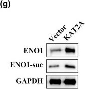 Fig.3.G showing Western Blotting in a Homo sapiens (Human) sample from the publication: KAT2A changes the function of endometrial stromal cells via regulating the succinylation of ENO1.