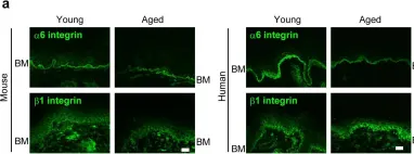 Fig.4.A showing Immunohistochemistry-immunofluorescence from the publication: Type XVII collagen coordinates proliferation in the interfollicular epidermis.