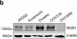 Fig.6.B showing Western Blotting in a Homo sapiens (Human) sample from the publication: ROR1-PI3K/AKT signaling drives adaptive resistance to cell cycle blockade in TP53 mutated ovarian cancer.