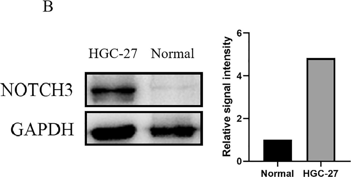 Fig.1.B showing Western Blotting from the publication: NOTCH3 as a prognostic biomarker and its correlation with immune infiltration in gastrointestinal cancers.