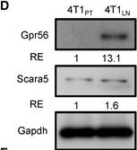 Fig.3.D showing Western Blotting in a Mus musculus (House mouse) sample from the publication: TGF-β1 secreted by Tregs in lymph nodes promotes breast cancer malignancy via up-regulation of IL-17RB.