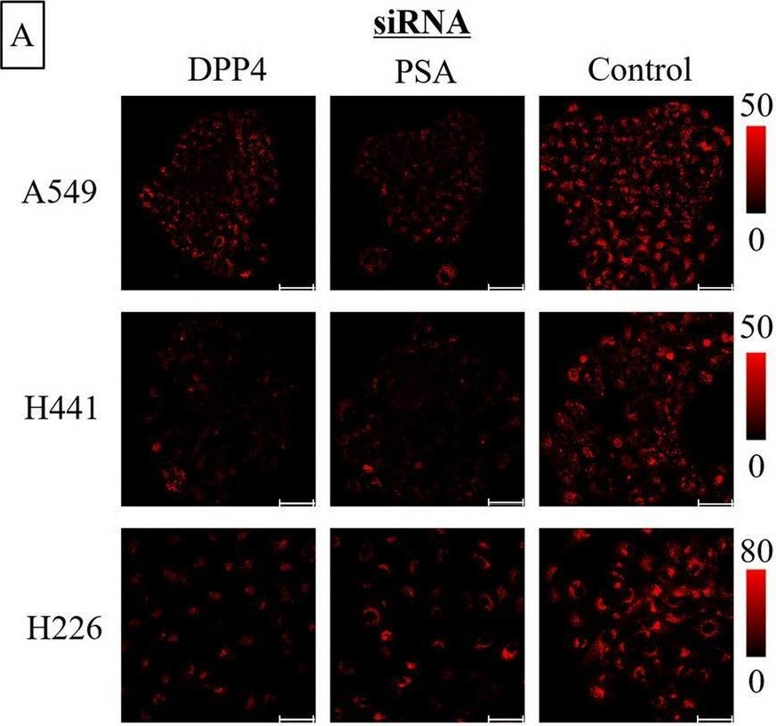 Fig.6.A showing Immunocytochemistry-immunofluorescence in a Homo sapiens (Human) sample from the publication: Rapid imaging of lung cancer using a red fluorescent probe to detect dipeptidyl peptidase 4 and puromycin-sensitive aminopeptidase activities.