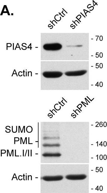 Fig.11.A showing Western Blotting in a Homo sapiens (Human) sample from the publication: Novel Role for Protein Inhibitor of Activated STAT 4 (PIAS4) in the Restriction of Herpes Simplex Virus 1 by the Cellular Intrinsic Antiviral Immune Response.