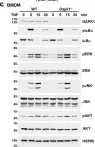Fig.5.C showing Western Blotting from the publication: Tumor suppressor death-associated protein kinase 1 inhibits necroptosis by p38 MAPK activation.