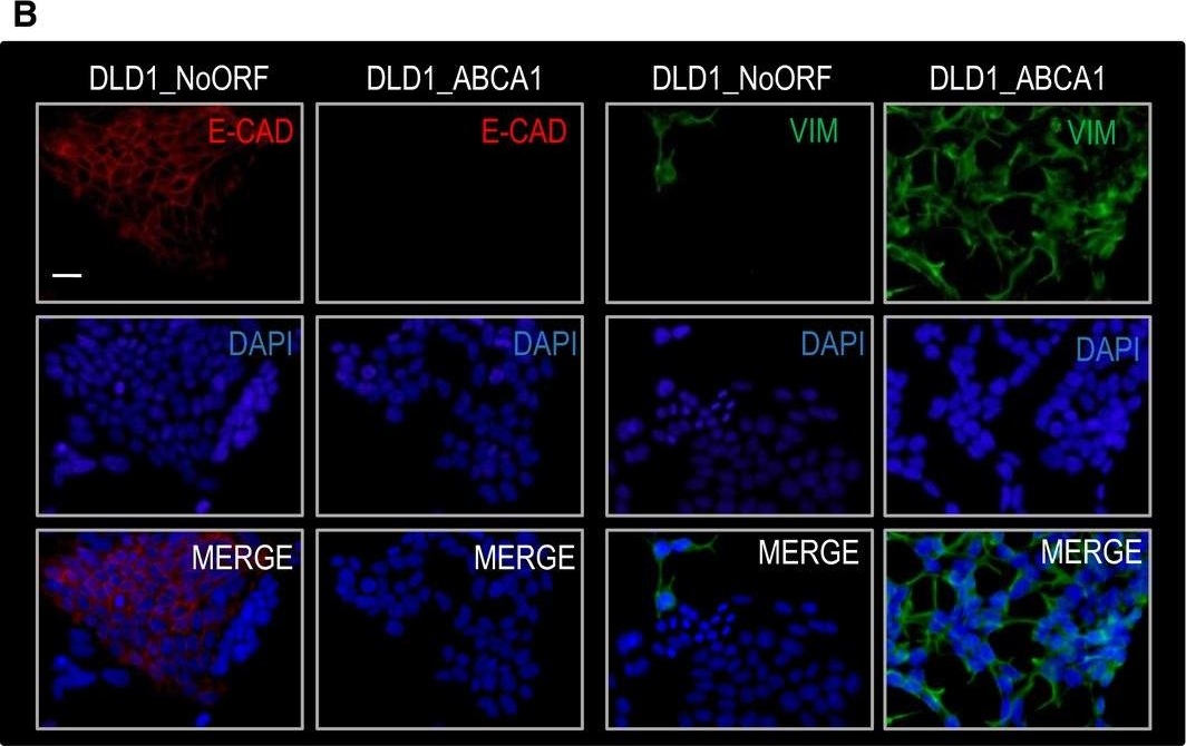 ABCA1 overexpression worsens colorectal cancer prognosis by facilitating tumour growth and caveolin-1-dependent invasiveness, and these effects can be ameliorated using the BET inhibitor apabetalone.
