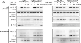 Fig.3.B showing Western Blotting from the publication: Sweet taste receptor agonists attenuate macrophage IL-1β expression and eosinophilic inflammation linked to autophagy deficiency in myeloid cells.