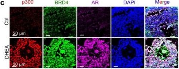 Fig.2.C showing Immunohistochemistry-immunofluorescence in a Mus musculus (House mouse) sample from the publication: Identification of A p300-SP1-BRD4 Transcriptional Axis as a Key Driver of AR Hyperactivation in Polycystic Ovarian Syndrome.