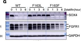 Fig.4.G showing Western Blotting from the publication: Targeting eIF4A triggers an interferon response to synergize with chemotherapy and suppress triple-negative breast cancer.