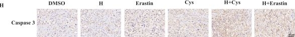 Fig.4.H showing Immunohistochemistry from the publication: Targeting SLC7A11-mediated cysteine metabolism for the treatment of trastuzumab-resistant HER2-positive breast cancer.