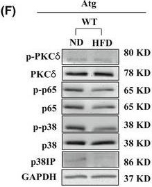 Fig.4.F showing Western Blotting from the publication: Dysregulated lipolysis and lipophagy in lipid droplets of macrophages from high fat diet-fed obese mice.
